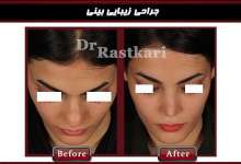 جراحی بینی دکتر راستکاری