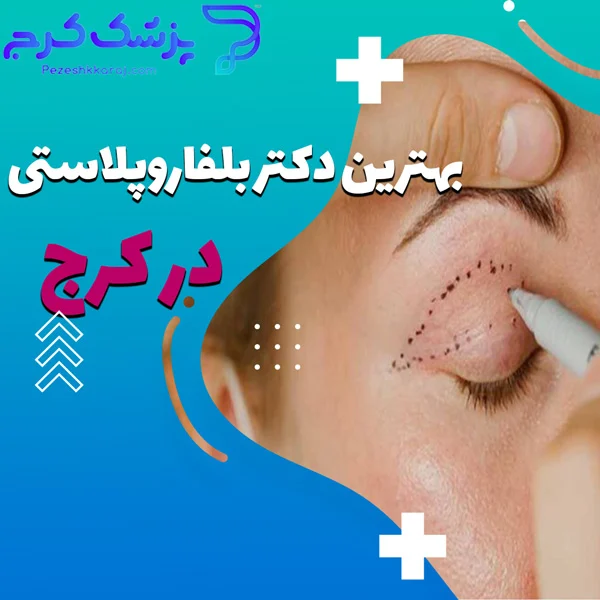 بلفاروپلاستی |عمل جراحی