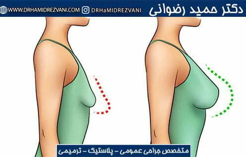 Side effects of injecting gel into the chest