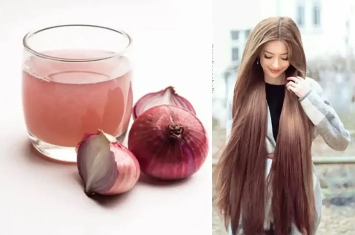 The benefits of onion juice for hair, the miracle of onion juice for hair growth and hair loss