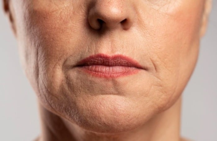 Why do women's faces wrinkle quickly?