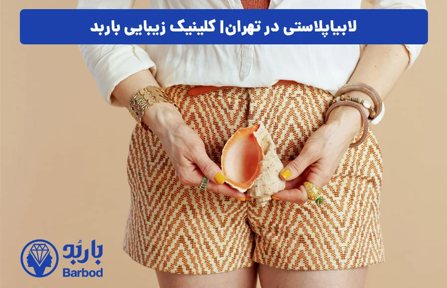 اپل |تهران