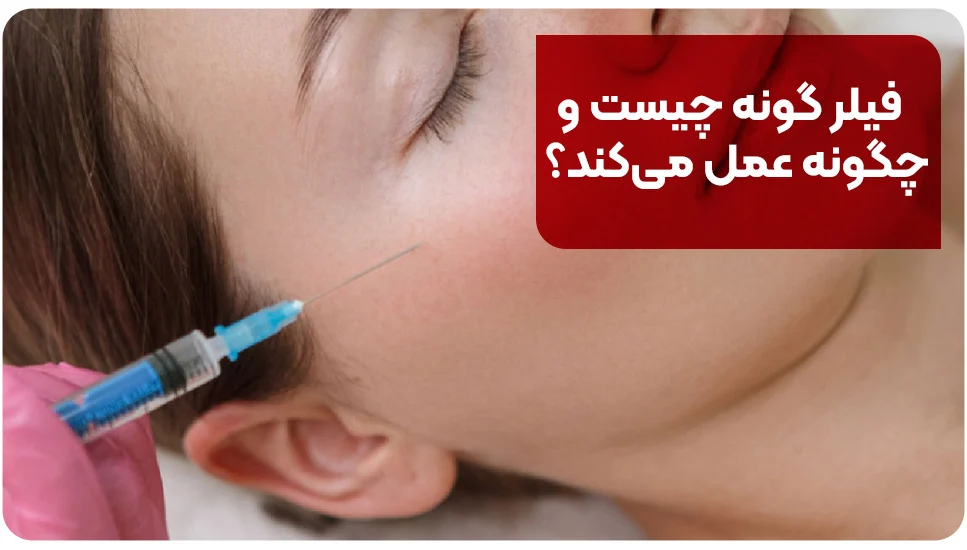 فیلر گونه چیست و چگونه عمل می&zwnj;کند؟