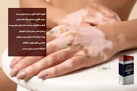 پوست |قهوه