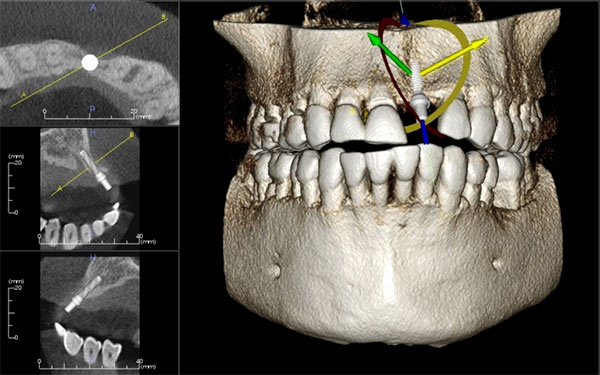 418web.jpg (600×375)