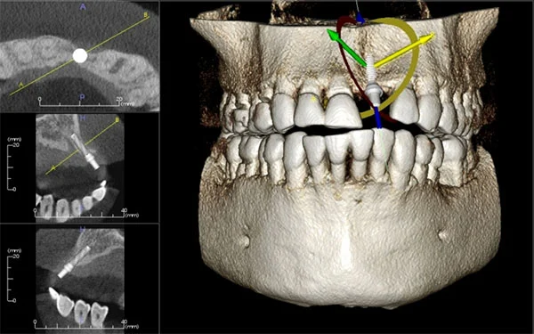 418web.jpg (600×375)