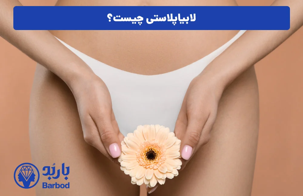اپل |تهران اپل |تهران