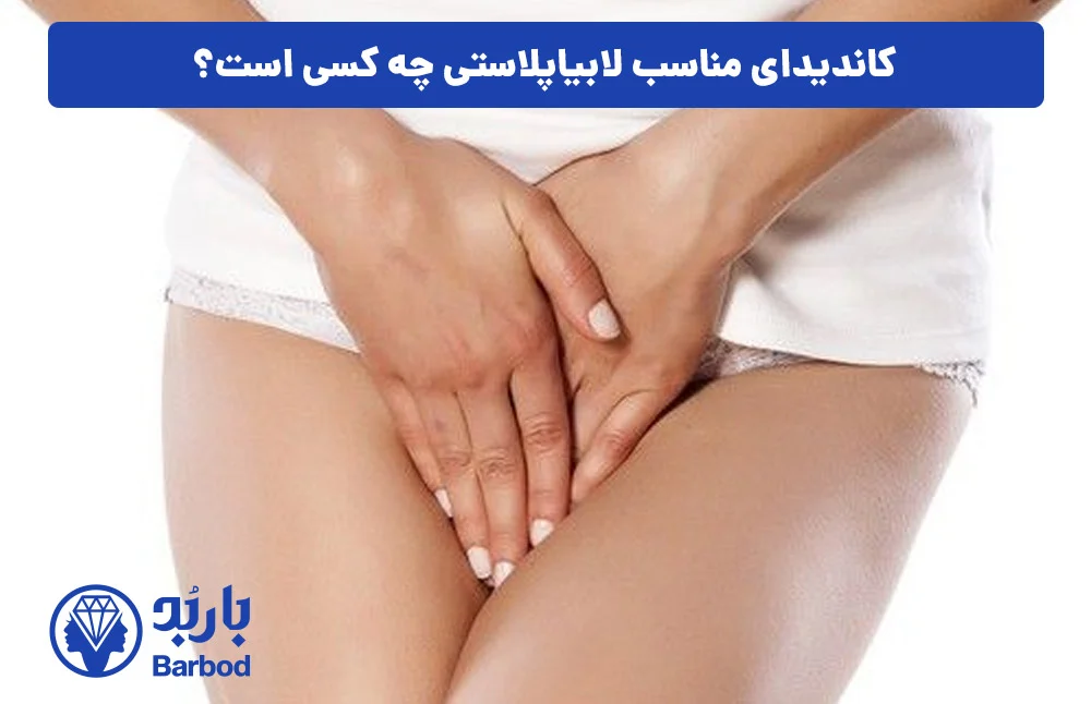 اپل |تهران اپل |تهران